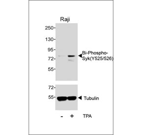 Western blot testing of lysate from human Raji cells that was untreated (-) and treated with 200 nm TPA for 30 min (+).