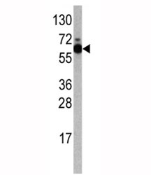 Western blot analysis of S6K antibody and Jurkat lysate. Predicted molecular weight: 60-70 kDa