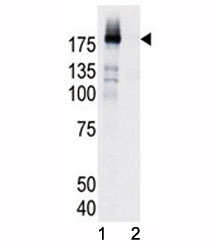 Western blot analysis of phospho-EGFR antibody and HeLa cell lysate, either induced (Lane 1) or noninduced with EGF (2).