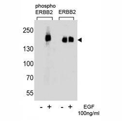 Western blot analysis of extracts from A431 cells, untreated or treated with EGF (100ng/ml), using phos-ERBB2 antibody (left) or nonphos Ab (right)