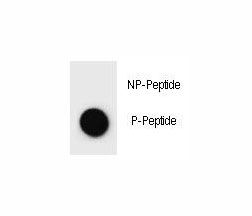 Dot blot analysis of phospho-c-Kit antibody. 50ng of phos-peptide or nonphos-peptide per dot were spotted.