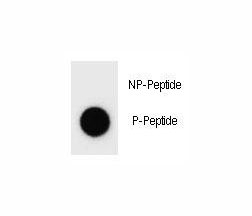 Dot blot analysis of phospho-c-Kit antibody. 50ng of phos-peptide or nonphos-peptide per dot were spotted.
