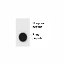 Dot blot analysis of phospho-CDKN2A antibody. 50ng of phos-peptide or nonphos-peptide per dot were spotted.