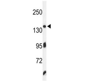 Western blot analysis of ZO-1 antibody and K562 lysate