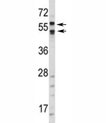 Western blot analysis of CA9 antibody and HepG2 lysate. Predicted molecular weight: 58 kDa and 54 kDa (soluble form).