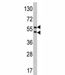 Western blot analysis of CA9 antibody and HeLa lysate. Predicted molecular weight: 58 kDa and 54 kDa (soluble form).