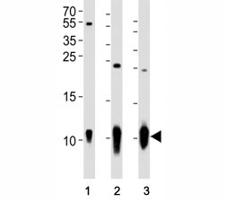 Western blot analysis of lysate from (1) A431 cell line, (2) mouse brain and (3) rat brain tissue using S100B antibody at 1:1000.  Predicted size: 11 kDa with a 21 kDa homodimer