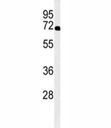 Western blot analysis of XRCC6 antibody and A2058 lysate.