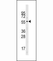 Western blot analysis of Cdc25A antibody and mouse kidney tissue lysate. Predicted molecular weight: 59-70 kDa.