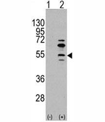 Western blot analysis of MEF2C antibody and 293 cell lysate (2 ug/lane) either nontransfected (Lane 1) or transiently transfected with the MEF2C gene (2).