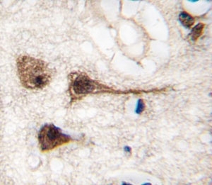IHC analysis of FFPE human brain tissue stained with MEF2C antibody