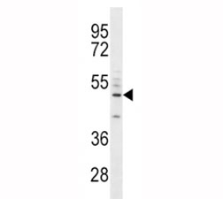 CD14 antibody western blot analysis in A549 lysate. Predicted size 40-55 kDa depending on glycosylation level