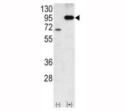 Western blot analysis of Amyloid beta antibody and 293 cell lysate either nontransfected (Lane 1) or transiently transfected with the APP gene (2). Predicted molecular weight 79~120kDa depending on glycosylation level.
