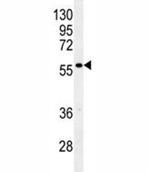 Glypican 3 antibody western blot analysis in mouse stomach tissue lysate