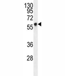 Glypican 3 antibody western blot analysis in HepG2 lysate