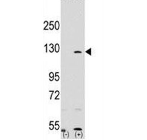 Western blot analysis of PARP antibody and 293 cell lysate (2 ug/lane) either nontransfected (Lane 1) or transiently transfected with the PARP1 gene (2).