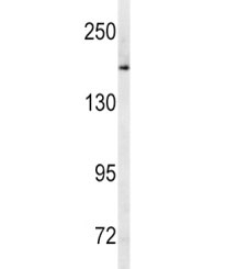 Western blot analysis of MRP1 antibody and human Ramos lysate. Predicted molecular weight: 152-172 kDa (multiple isoforms), can be observed at ~190 kDa.