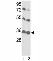 Western blot analysis of VDAC1 antibody and 1) HL-60 and 2) Y79 lysate.