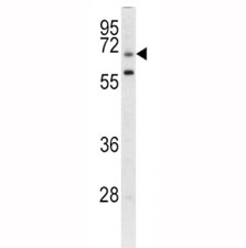 Western blot analysis of GARP antibody and CEM lysate.