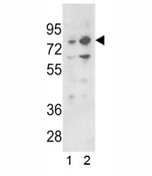 Western blot analysis of PLZF antibody and 1) 293 and 2) K562 lysate. Predicted molecular weight: 74-81 kDa.