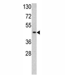 Western blot analysis of TBP antibody and HL-60 lysate. Observed molecular weight: 35-43 kDa.