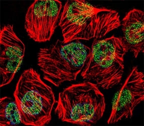 Fluorescent confocal image of U251 cell stained with TBP antibody at 1:25. TBP immunoreactivity is localized to the nucleus.