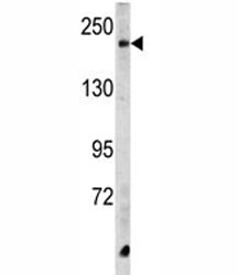 Western blot analysis of CPD antibody and HeLa lysate.