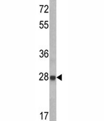 Western blot analysis of IGFBP6 antibody and CEM lysate. Predicted molecular weight: ~23-25kDa.