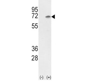 Western blot analysis of Ku70 antibody and 293 cell lysate (2 ug/lane) either nontransfected (Lane 1) or transiently transfected with the Ku70 gene (2). Predicted molecular weight ~70kDa.
