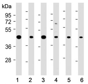 Western blot testing of human 1) A431, 2) MOLT4, 3) Jurkat, 4) PC-12, 5) mouse NIH3T3 and 6) mouse brain lysate with ASS1 antibody at 1:2000. Predicted molecular weight ~46 kDa.