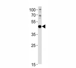 PAX6 antibody western blot analysis in U251 lysate. Predicted molecular weight ~48kDa.