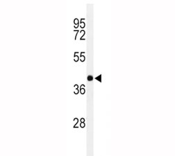 Western blot analysis of PAX-6 in Y79 lysate. Predicted molecular weight ~48kDa.