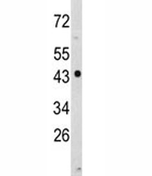 Western blot analysis of NDRG1 antibody and MDA-MB231 lysate. Predicted molecular weight ~43kDa.