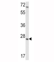 Western blot analysis of IGFBP4 antibody and mouse lung tissue lysate. Predicted molecular weight: ~28kDa.