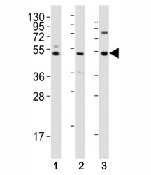 Western blot testing of LAG3 antibody at 1:2000 dilution tested on human lysates, Lane 1: K562; 2: liver; 3: ovary; Predicted molecular weight ~54 kDa.