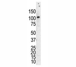 Western blot analysis of PKC nu antibody in lysate of HL-60 cells stimulated with PMA.