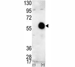 Western blot analysis of AKT2 antibody and 293 cell lysate (2 ug/lane) either nontransfected (Lane 1) or transiently transfected with the human gene (2). Predicted molecular weight: ~56kDa.