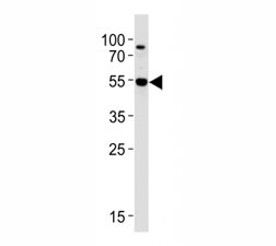 Western blot analysis of lysate from Jurkat cell line using AKT3 antibody at 1:1000. Predicted molecular weight: ~56kDa but can be observed from 60~65kDa.