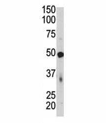 Western blot of PDK4 antibody and mouse skeletal muscle tissue lysate. Predicted molecular weight ~46 kDa