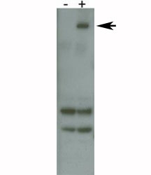 PARK8 / LRRK2 antibody detects over-expressed human LRRK2 protein.