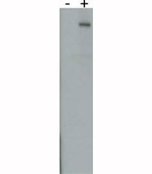 LRRK2 antibody detect over-expressed human LRRK2 protein.