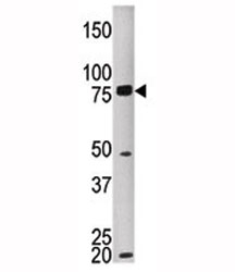 Western blot testing of MELK antibody and HEPG2 lysate. Predicted molecular weight ~ 73 kDa.