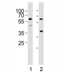 Western blot analysis of lysate from 1) HT-29 and 2) K562 cell lines using RIPK3 antibody at 1:1000. Predicted molecular weight ~57 kDa.