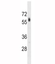 SPHK2 antibody western blot analysis in HepG2 lysate. Predicted molecular weight ~69 kDa.