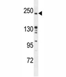 RICTOR antibody western blot analysis in mouse bladder tissue lysate.