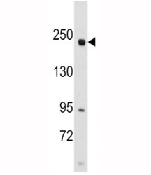 Western blot analysis of RICTOR antibody and SK-BR-3 lysate.