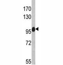 Western blot analysis of anti-NLRP12 antibody and HL-60 lysate. Predicted molecular weight: ~119kDa, routinely observed at 100~119kDa.