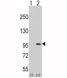 Western blot analysis of DDR1 antibody and 293 cell lysate (2 ug/lane) either nontransfected (Lane 1) or transiently transfected with the DDR1 gene (2). Predicted molecular weight: 100~125KD.