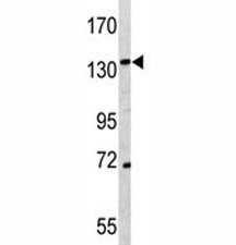 Western blot analysis of CD163 antibody and K562 lysate