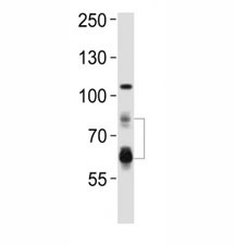 Western blot analysis of lysate from HeLa cell line using PCSK9 antibody.  Predicted size: Pro/mature ~74/64 kDa